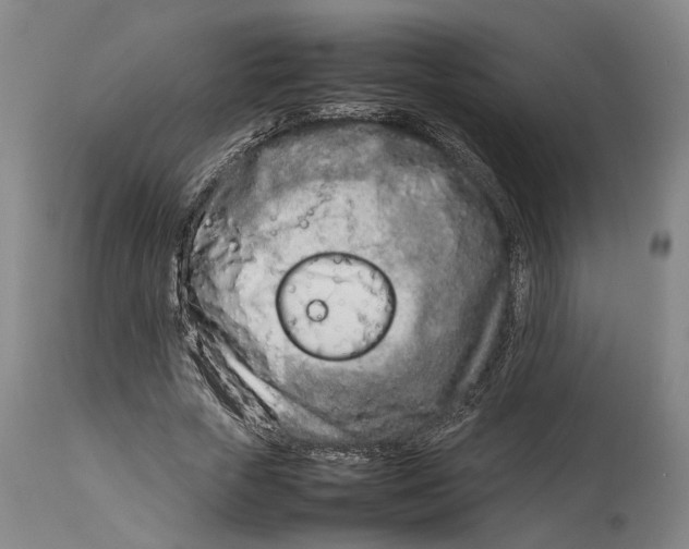 X0000114140729200911051420