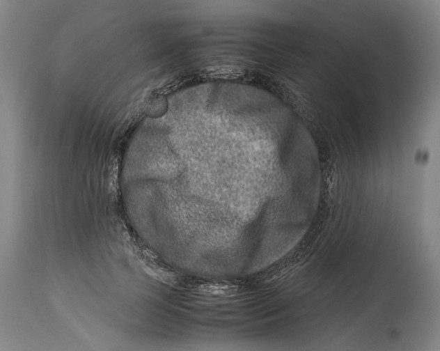 X0000114140745200911051420