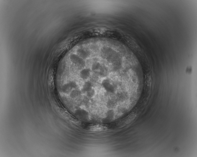 X0000114140754200911051420