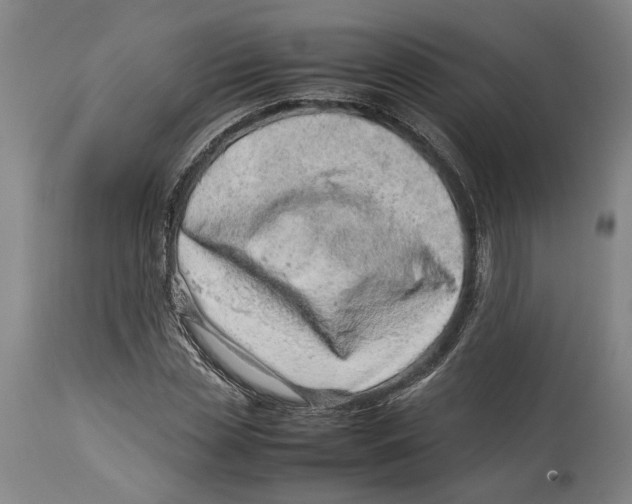 X0000114140829200911051419