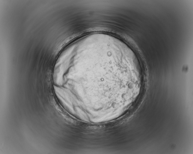 X0000114140937200911051418