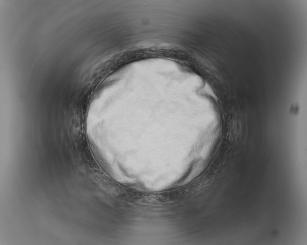 X0000114140966200911051417