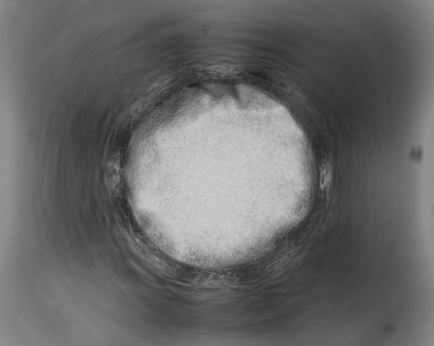 X0000114141011200911051416