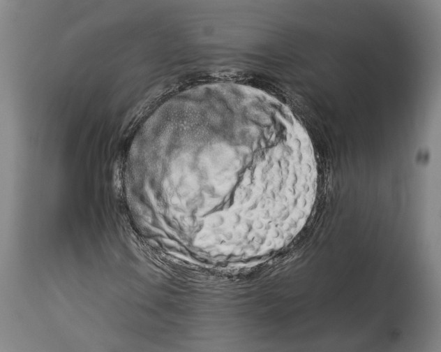 X0000114141106200911051415