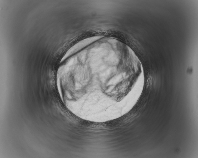 X0000114141156200911051415