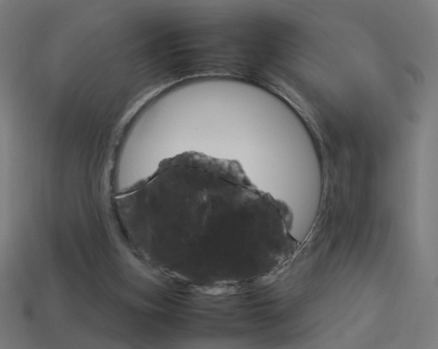 X0000114150155200910081120