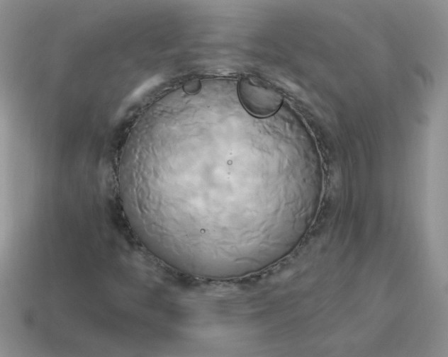 X0000114151446200910221536