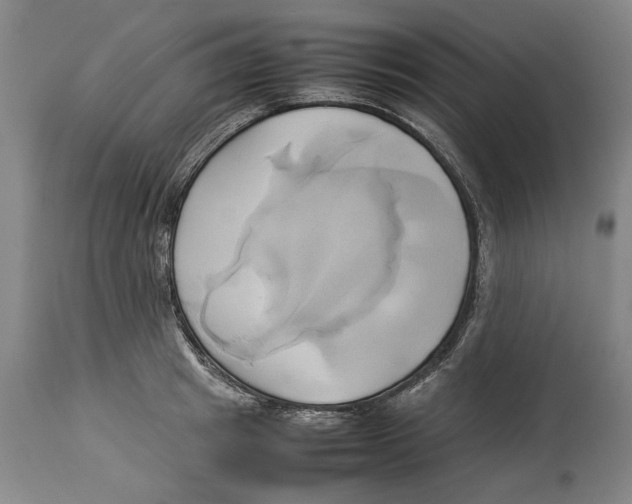 X0000114150849200911051441