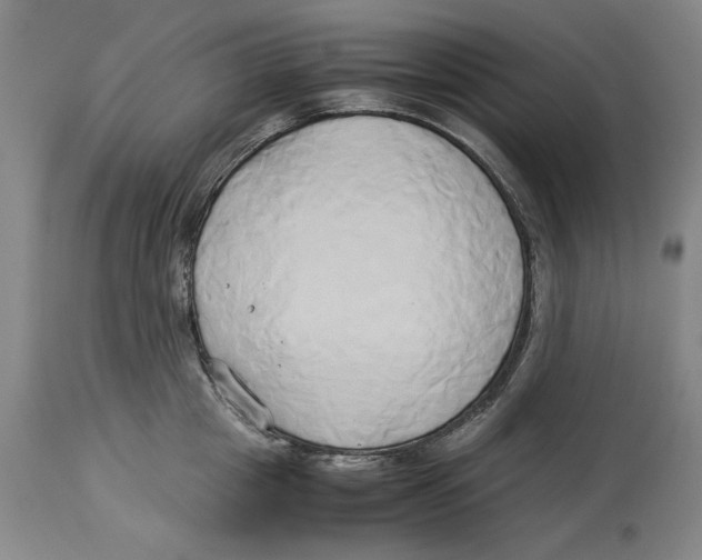 X0000114150857200911051441