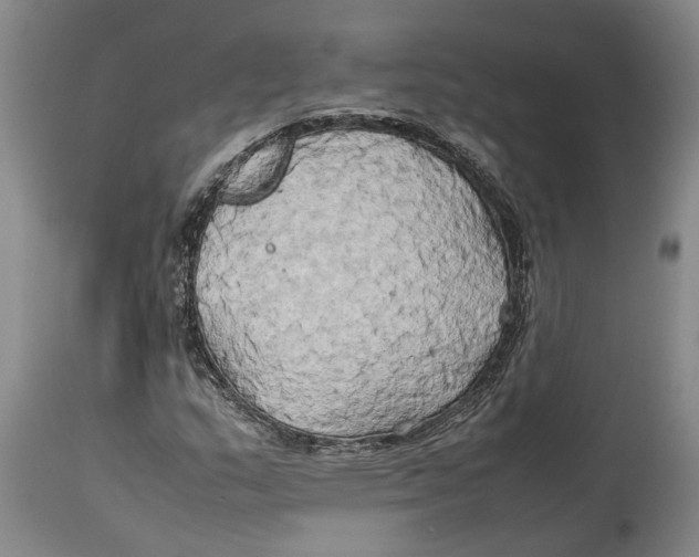 X0000114151159200911051436