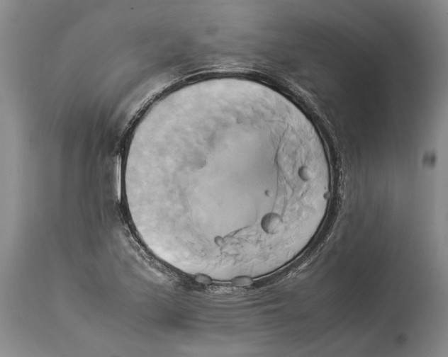 X0000114151171200911051436