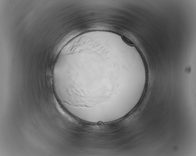 X0000114151433200911051433