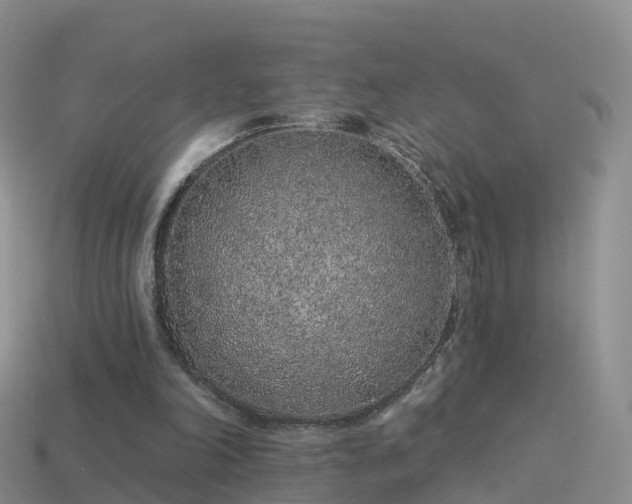 X0000114160198200910151614