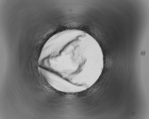 X0000114161297200911051455