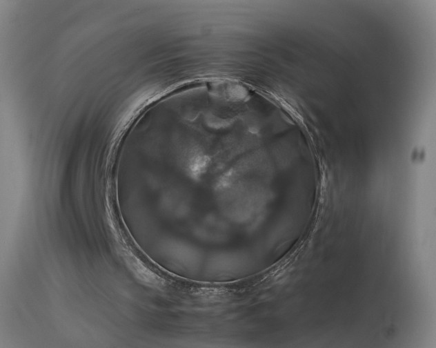 X0000114170145200910151645