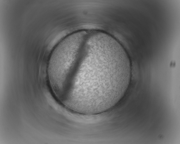 X0000114170015200910221701