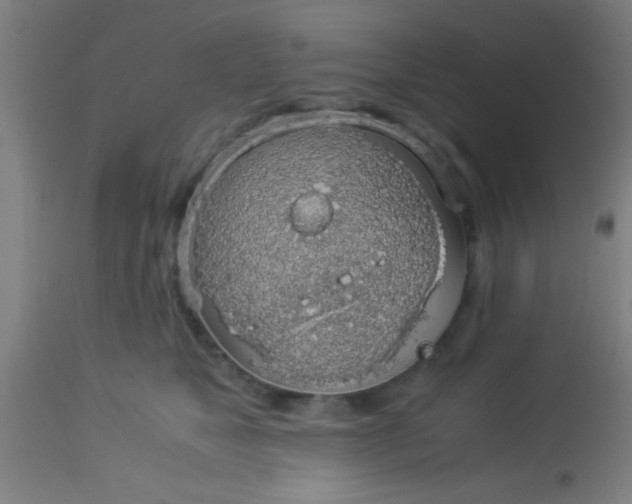 X0000114170517200910221654