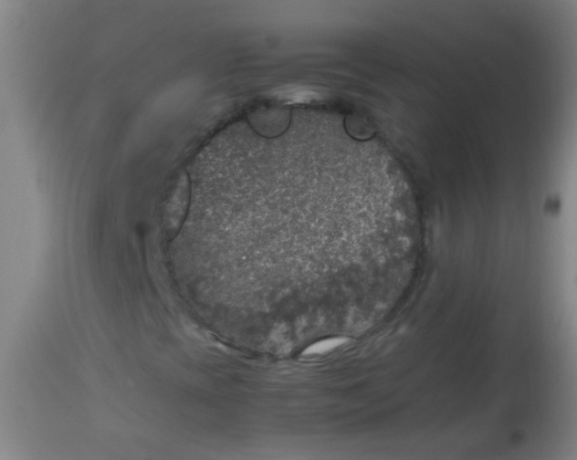 X0000114171393200910221640