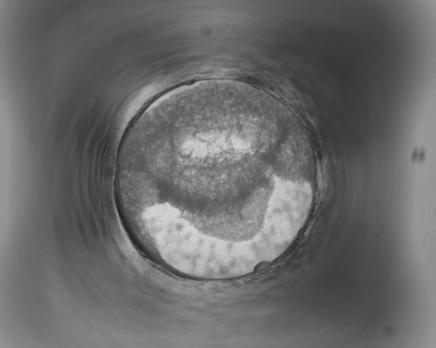 X0000114170003200911051538