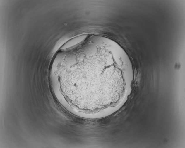 X0000114170099200911051537