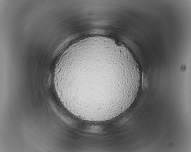 X0000114170157200911051535