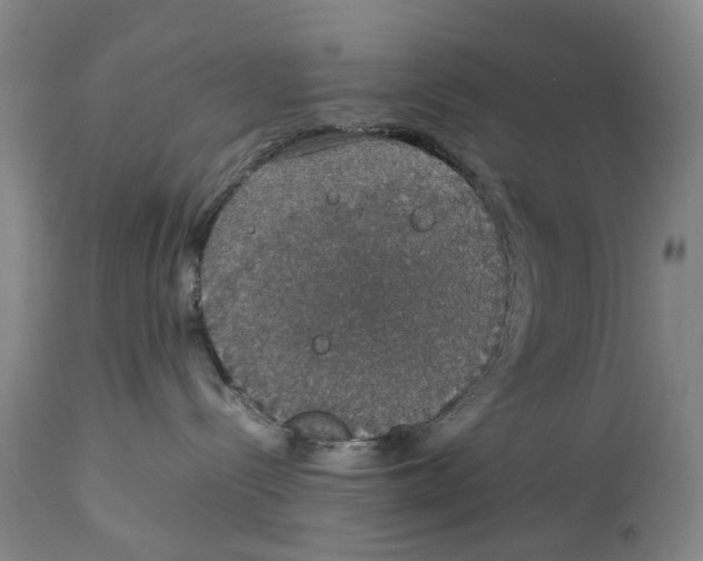 X0000114170288200911051534