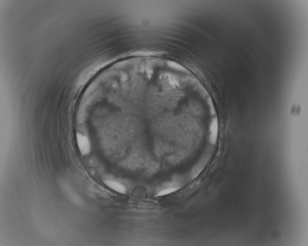 X0000114170337200911051532