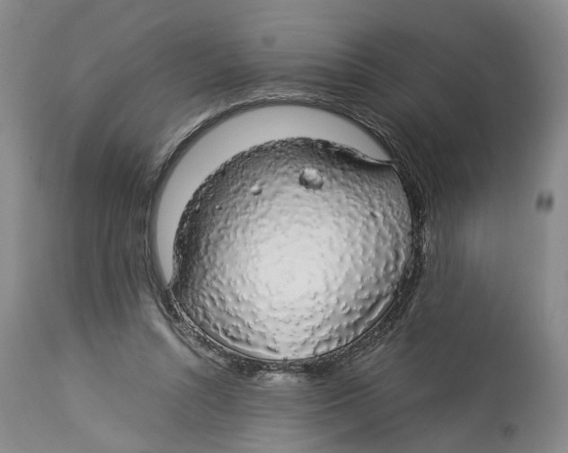 X0000114170352200911051533