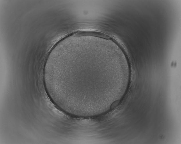 X0000114170385200911051532