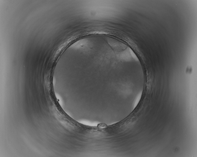 X0000114170386200911051532