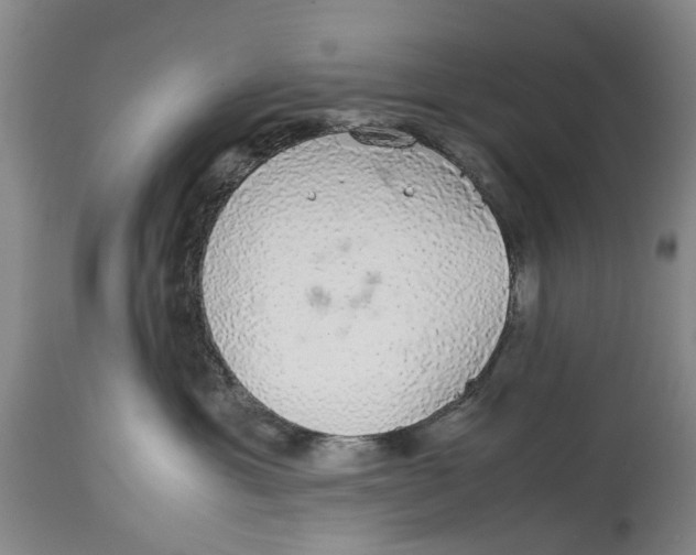 X0000114170429200911051532