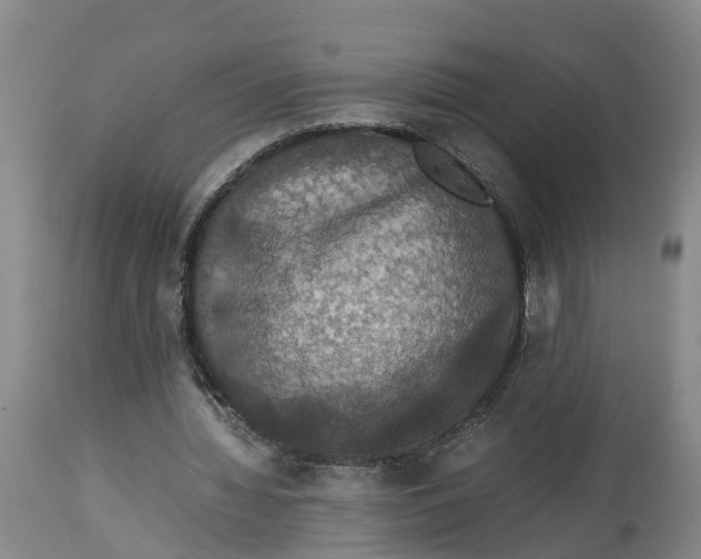 X0000114170436200911051531