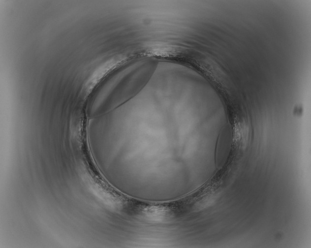 X0000114170444200911051531