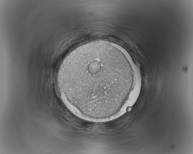 X0000114170517200911051530