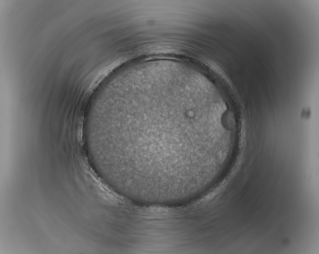 X0000114170777200911051526