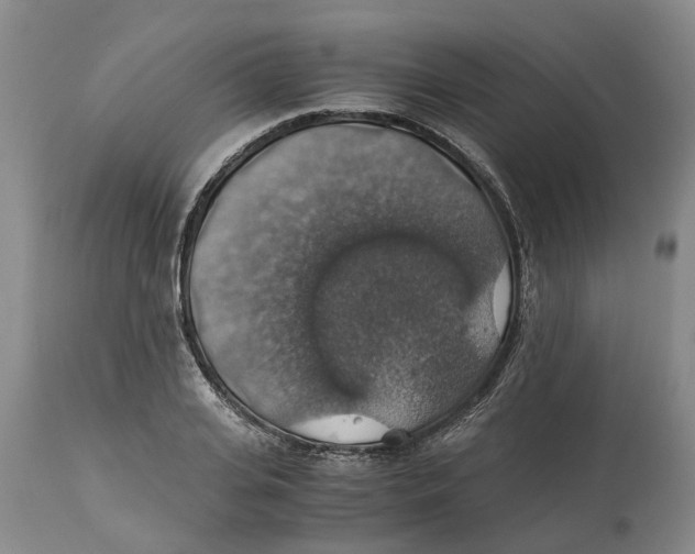 X0000114170935200911051524