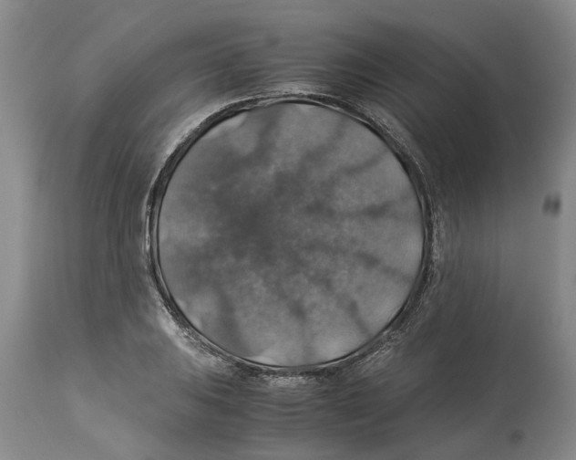 X0000114171031200911051523