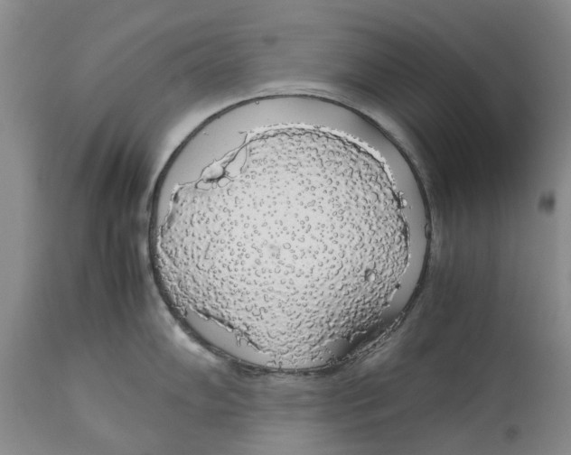 X0000114171102200911051522