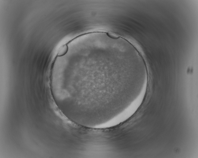 X0000114171104200911051522