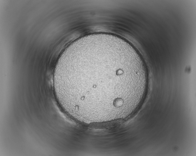 X0000114171241200911051520