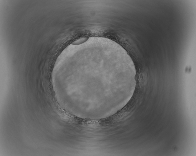 X0000114171249200911051520