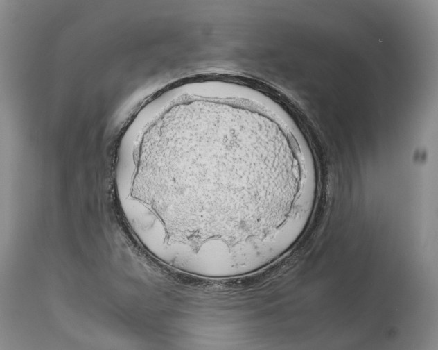 X0000114171359200911051518