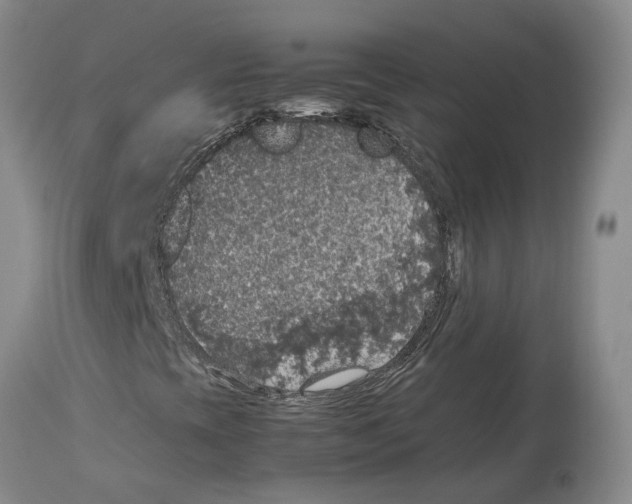 X0000114171393200911051517