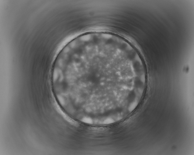 X0000114171429200911051517