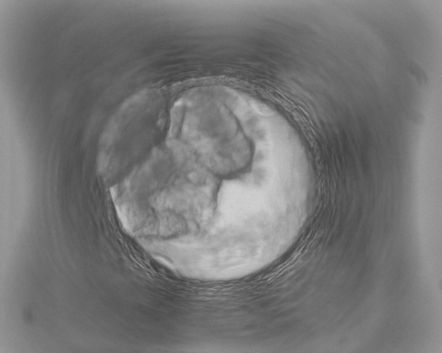 X0000114171393200911191237