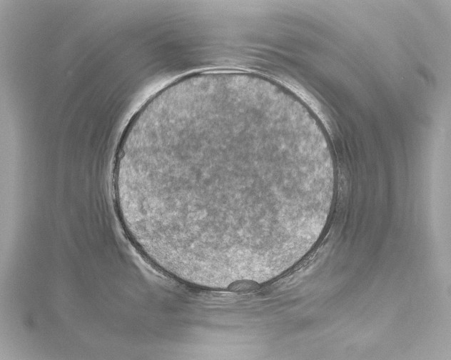 X0000114171485200911191236