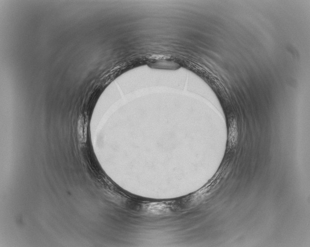 X0000114180180200911191315