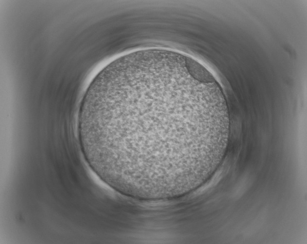 X0000114191535200911061352