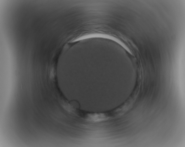 X0000114200517200910161227