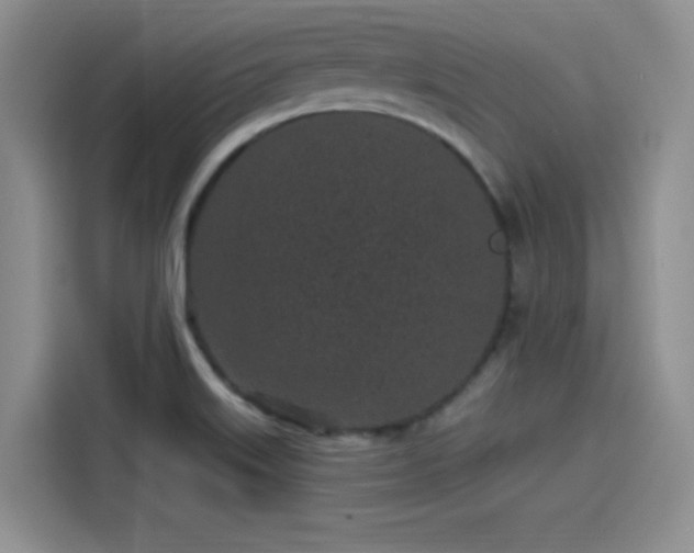 X0000114201515200910161214